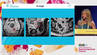 How to Perform and Interpret an MRI in Rectal Cancer [upl. by Lounge]