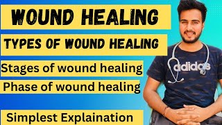 Wound Healing pathologyTypes of wound healingStages of Wound HealingPhase of wound healing [upl. by Ardnasella74]