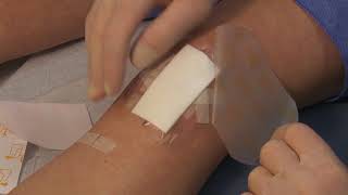 How to Apply Dressing After Knee Surgery  Knee Arthroscopy PostOperative Care [upl. by Tanitansy]