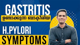 Hpylori symptoms I Dr Sijil K S [upl. by Kerrin]