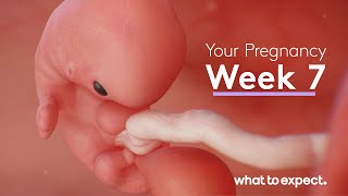 7 Weeks Pregnant  What to Expect [upl. by Ruscio671]