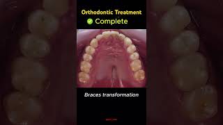 trending dentist dentalclinic orthodontist dental smile braces dentistry shorts yt bds [upl. by Samid]