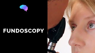 Fundoscopy Ophthalmoscopy  OSCE Guide  UKMLA  CPSA [upl. by Attenyt146]