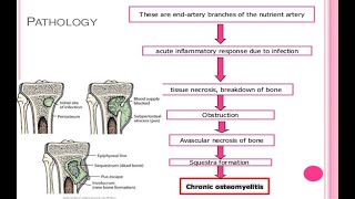 chronic osteomyelitis [upl. by Naig925]