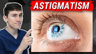 Astigmatism Explained  What You Need to Know [upl. by Akiraa]