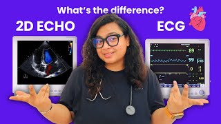 ECHO Test VS ECG Test Explained  Echocardiogram vs Electrocardiogram for Heart [upl. by Felise]