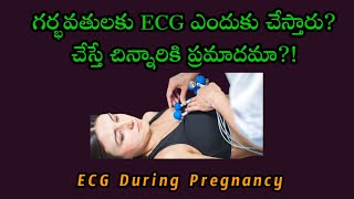 ECG during pregnancy in Telugu Electro Cardiogram  Pregnancy test momgeethastips [upl. by Ikkaj]