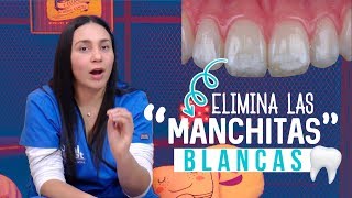 Manchas Blancas en los Dientes ¡Como QUITARLAS 👌 [upl. by Jaylene]