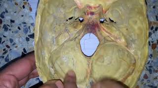 MENINGES OF SKULL dura matter easy explanation 1 [upl. by Aerdied]