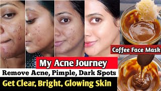 I used Coffee face pack for remove Acne pimple dark spots free skin coffee face mask skin whitening [upl. by Ansev]