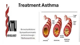 treatment of Asthma kmu pediatric health nursing 6 [upl. by Oludoet598]