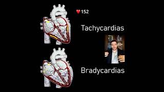 Tachycardias vs Bradycardias part 2 🫀⚡ Shorts [upl. by Ahsiekin310]