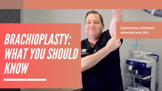 Brachioplasty arm lift things you should know [upl. by Ipoillak]