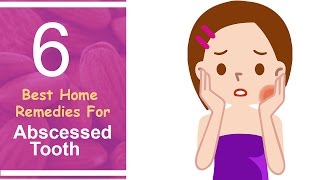 6 Best Home Remedies For Abscessed Tooth [upl. by Aicarg4]