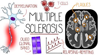 Understanding Multiple Sclerosis Multiple Sclerosis Explained [upl. by Acacia]