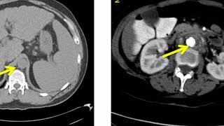 Introduction to Radiology Computed Tomography [upl. by Eiramac]