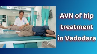 AVN Avascular Necrosis of hip treatment [upl. by Aerdnahs]