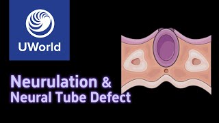 Neurulation amp Neural Tube Defects  Anencephaly Spina Bifida Occulta  USMLE Uworld Step 1 MBBS [upl. by Thane]