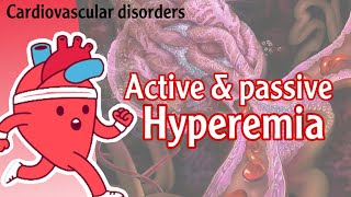 Hyperemia  active and passive Cardiovascular diseases شرح [upl. by Jareen23]