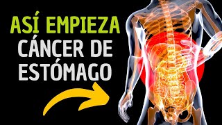 Descubre los 5 síntomas EXTRAÑOS del cáncer de estómago [upl. by Atirhs]