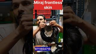 Miraz frontless skin hair patch youtub trending viralvideo shortsvideo [upl. by Yci]