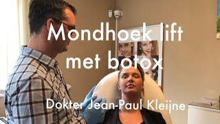 Mondhoeken liften met botox  Art de la Beauté  Dokter JeanPaul Kleijne [upl. by Ahsatak820]