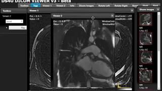 DreamSoft4u DICOM  PACS Imaging Solution [upl. by Heywood685]