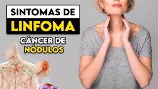 TOME CUIDADO Estes são os sinais e sintomas do LINFOMA │ Médico Explica [upl. by Xavier]