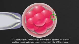 RI Saturn 5™ Active laser [upl. by Leonard]