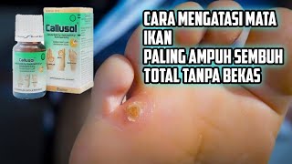 CARA MENYEMBUHKAN MATA IKAN AMPUH TANPA BEKAS TANPA OPRASI [upl. by Liek30]