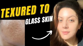 How to treat textured skin  Bumpy skin texture I Closed comedones treatment  Pitted scar treatment [upl. by Kulseth]