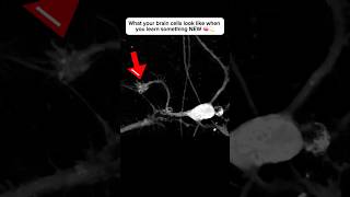 Brain cell restructures itself after forming a new connection neuroplasticity neuroscience brain [upl. by Chaworth]