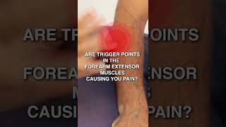 Are Trigger Points In The Forearm Extensor Muscles Causing You Pain [upl. by Weldon540]