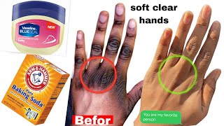 How to make your hand Soft Wrinklefree with baking soda an vaseline get Clear youngerlooking [upl. by Nenney]