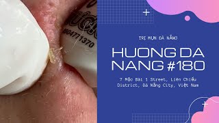 180  Huong Da Nang [upl. by Fortunio]