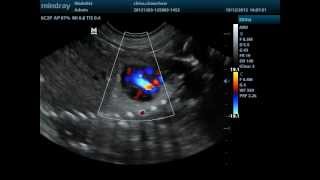 Doppler cardiaco fetal canino [upl. by Ahsets53]