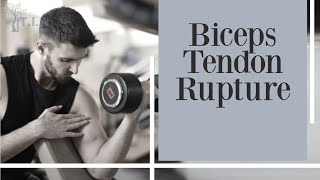 Biceps Tendon Rupture  biceps injury [upl. by Lanaj]