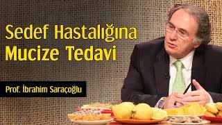 Sedef Hastalığına Mucize Tedavi  Prof İbrahim Saraçoğlu [upl. by Amrac964]