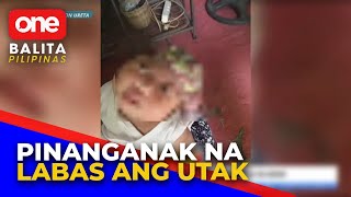 Anencephalic baby nabuhay lang sa loob ng 24 araw [upl. by Novets]