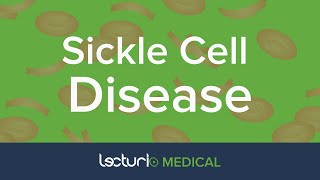 Sickle Cell Hemoglobin SS Disease Acute amp Chronic Presentation  Pediatrics [upl. by Sweatt]