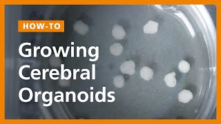 How to Grow Cerebral Organoids from Human Pluripotent Stem Cells [upl. by Nels]