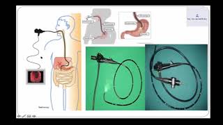 Endoscopie Digestive [upl. by Romy]