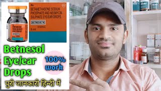 Betnesol N drops use dose benefits and Side effects Full in hindi पुरी जानकारी हिन्दी में [upl. by Haas]