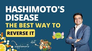 What is Hashimotos Disease Symptoms of Hashimotos  The Best way to Reverse Hashimotos Disease [upl. by Debbie]