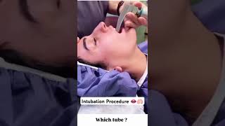 Intubation procedure in 5 seconds 👄🫁 shorts intubation trending youtubeshorts love song [upl. by Renard]