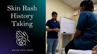 MRCEM OSCE  Skin Rash History Taking [upl. by Ecertal]