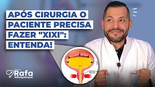 Por que após uma cirurgia o paciente precisa ter a diurese espontânea 🤨 [upl. by Mcarthur425]