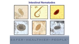 Diagnostic Features of Intestinal Nematodes [upl. by Alamat]