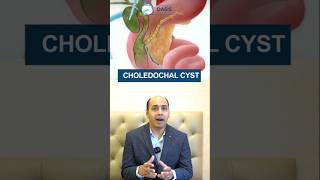 What is Choledochal Cyst  Dr Aditya Kulkarni dradityakulkarni oasisclinic bileductcyst shorts [upl. by Packer647]