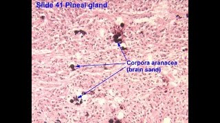 Histology of Brain sand also known as Corpora Arenacea found in the pineal Gland [upl. by Alarise]